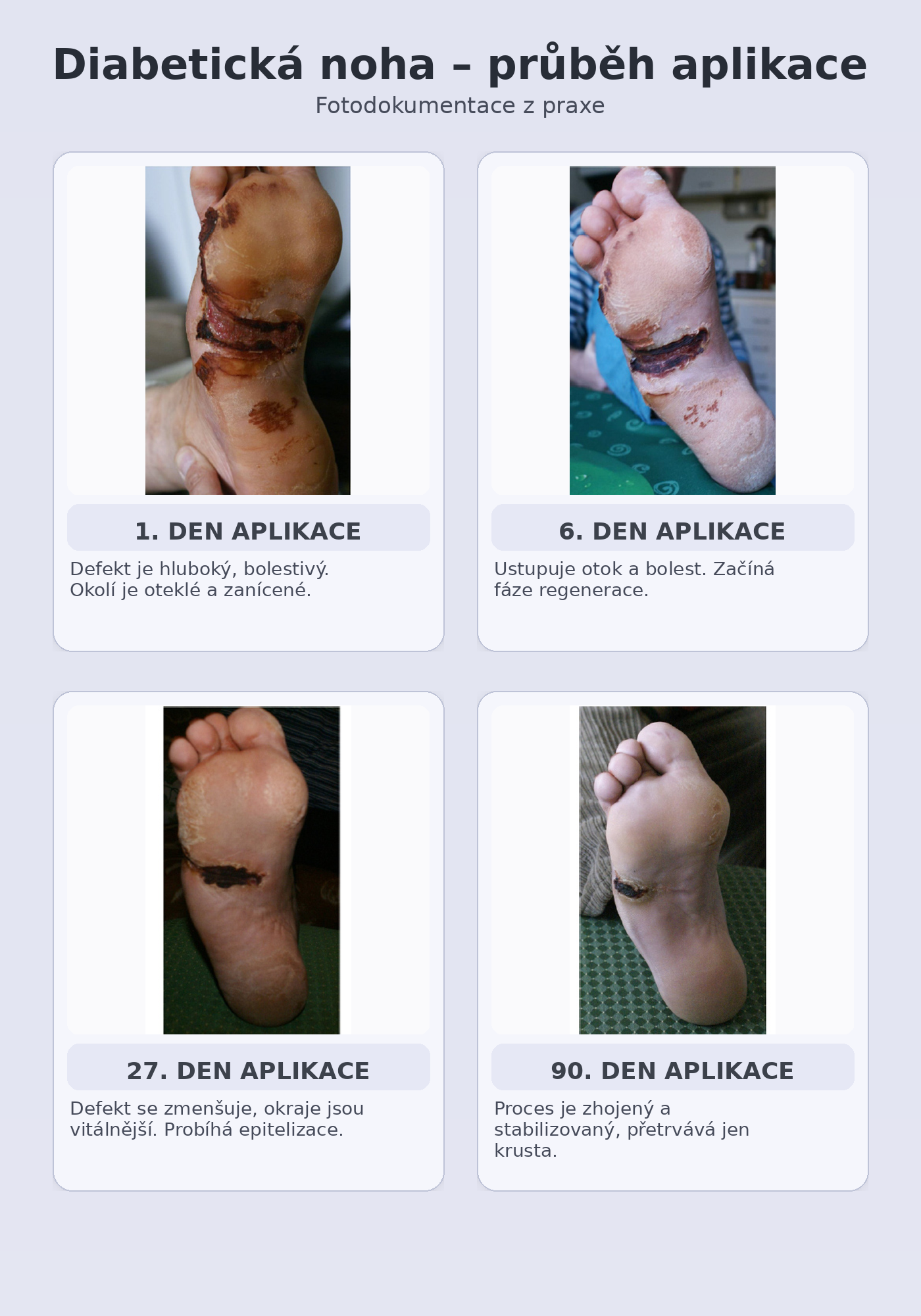 diabeticka_noha_fotky_s_popisky