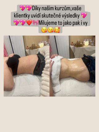 Kurzy Maderoterapie a Lymfomodelingu ❤️Učím tak jak bych chtěla být učena já🎀💖❤️s láskou,pokorou,úsměvem a naprostou...