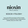 Nioxin Scalp Recovery System Shampoo 200ml 09