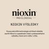 Nioxin Scalp Purifying Exfoliator 50ml 09