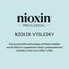 Nioxin Scalp Recovery System KIT Shampoo 200ml Conditioner 200ml Treatment 100ml 09
