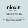 Nioxin Volumizing Thickening Mousse 192g 09