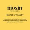 Nioxin System KIT 1 Treatment 100ml 09