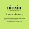 Nioxin System KIT 2 Shampoo 300ml 09