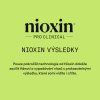 Nioxin Scalp + Hair Conditioner System 2 (Velikost 1000 ml)