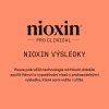 Nioxin System KIT 4 Shampoo 300ml 09