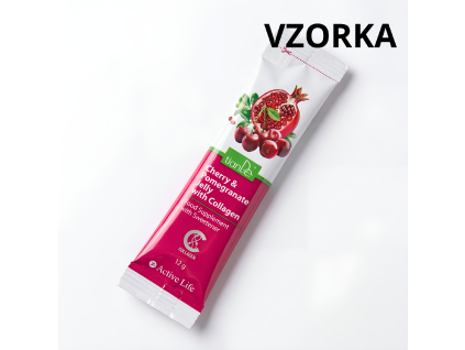 vzorky