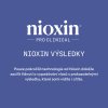 Nioxin Night Density Rescue Serum 70ml 09