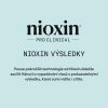 Nioxin Scalp Recovery System Shampoo 200ml 09