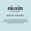 Nioxin Scalp Recovery Soothing Serum 100ml 09
