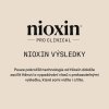 Nioxin Scalp Purifying Exfoliator 50ml 09