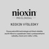 Nioxin Anti breakage Strengthening Mask 150ml 09
