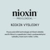 Nioxin Strong Hold Hairspray 400g 09