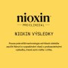 Nioxin System KIT 1 Treatment 100ml 09