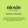 Nioxin System KIT 2 Treatment 100ml 09