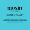 Nioxin System KIT 3 Shampoo 300ml 09