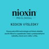 Nioxin System KIT 3 Shampoo 150ml Conditioner 150ml Treatment 50ml 09