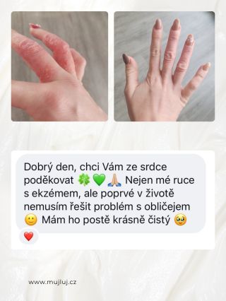 Ani neumíme říct, jak rádi čteme tyhle zprávy od vás 🥹 Už když jsme začínali, chtěli jsme produkt, který vyživí i tu...