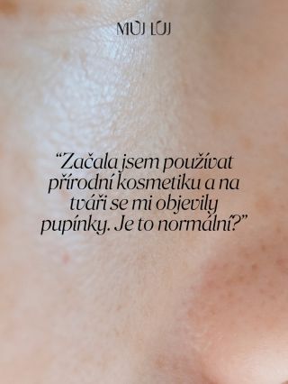 Proč se tohle děje? A je to vůbec normální? 👇 Občas se to po přechodu na přírodní kosmetiku stane. A není to důvod k...