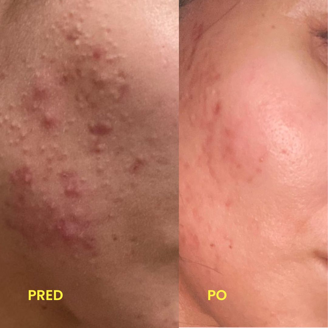 Premena — sebavedomie