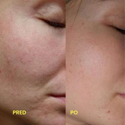 Premena zákazníčky