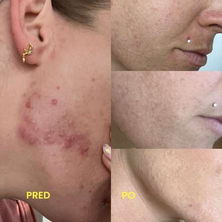 Premena zákazníčky