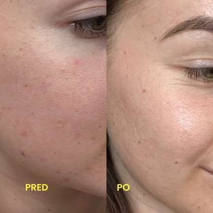 Premena zákazníčky