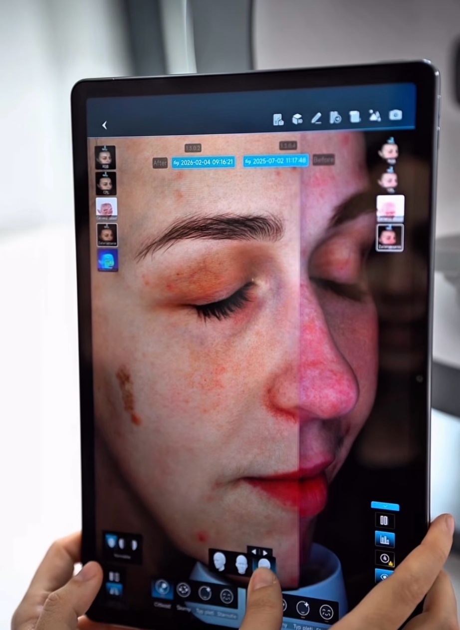 Výsledky diagnostiky