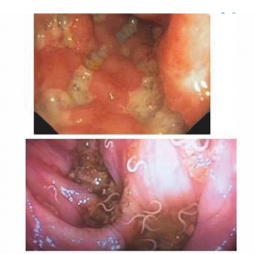 🧬 Co je biofilm a proč ho nechcete?