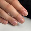 Cuticle remover