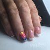 Vision AcryGel