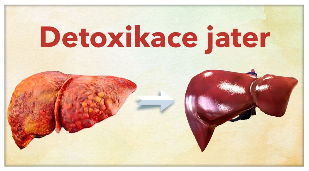 Detoxikace