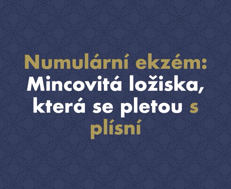 Numulární (diskoidní) ekzém: Mincovitá ložiska, která se pletou s plísní