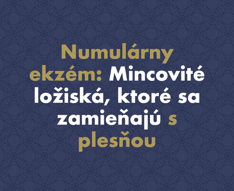 Numulárny (diskoidný) ekzém: Mincovité ložiská, ktoré sa zamieňajú s plesňou