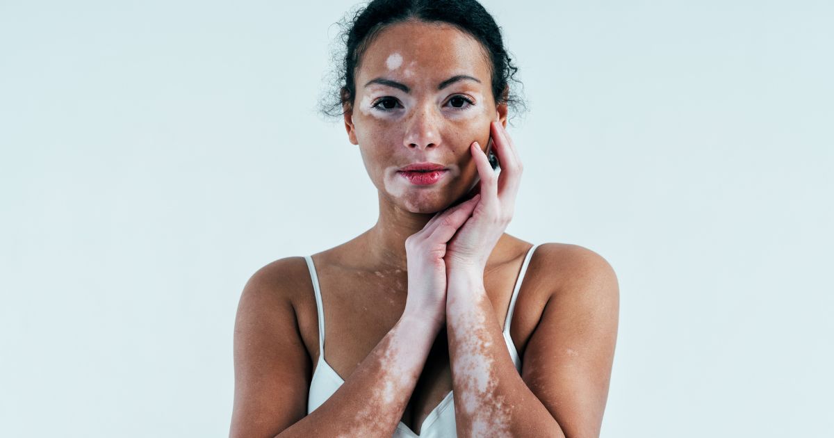 melanin-vlasy