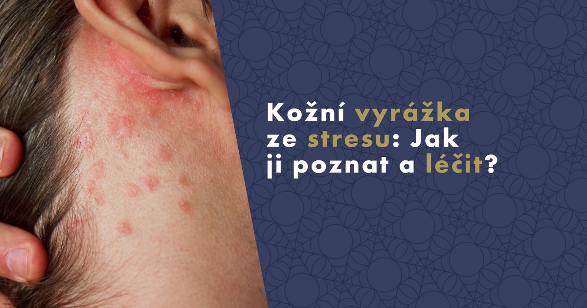 kozni-vyrazka-ze-stresu