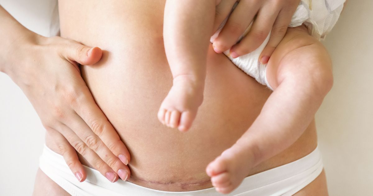 Starostlivost-po-porode