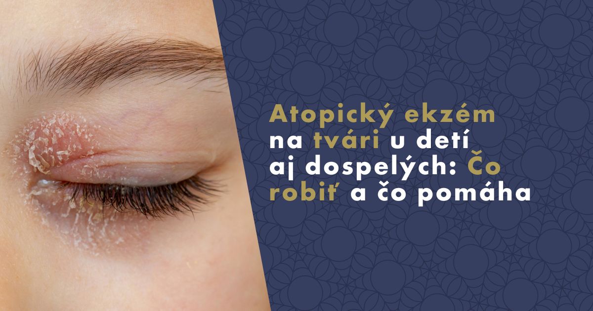 atopicky-ekzem-na-tvari