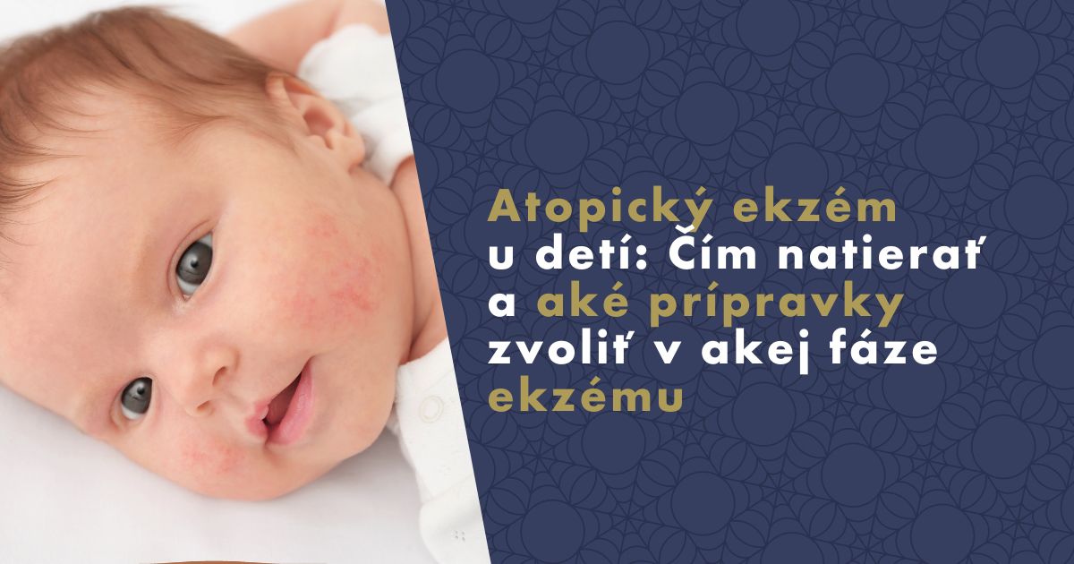 atopicky-ekzem-u-deti-sk