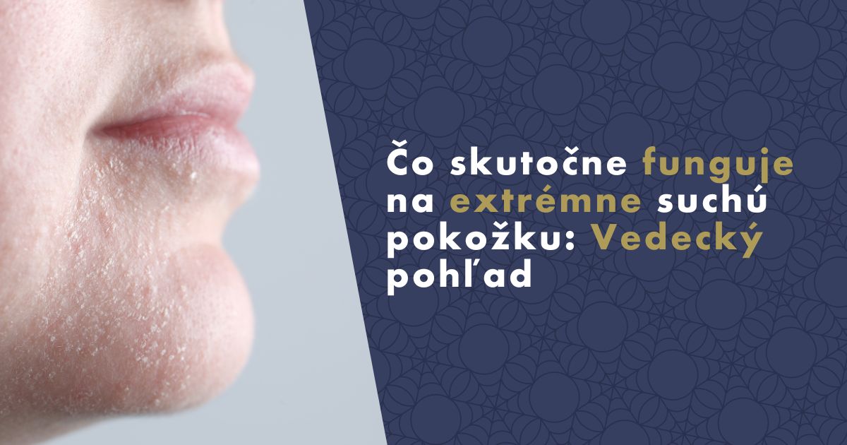 co-skutocne-funguje-na-suchu-plet