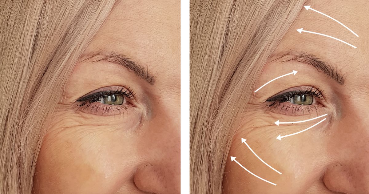 eye-serum-for-wrinkles-between-the-eyes