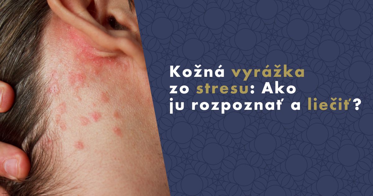 kozna-vyrazka-zo-stresu