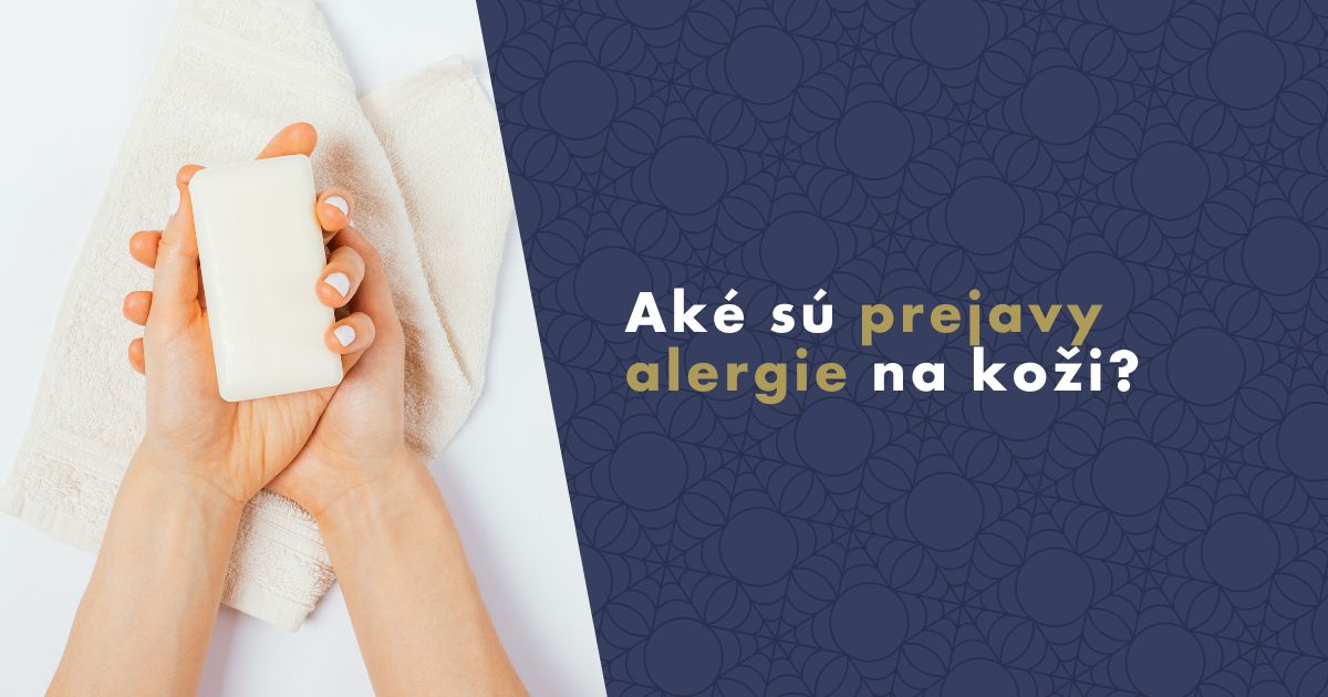 prejavy-alergie-na-kozi-fb