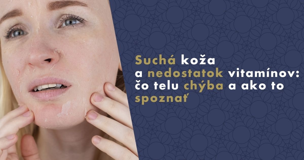 sucha-koze-a-nedostatok-vitaminov