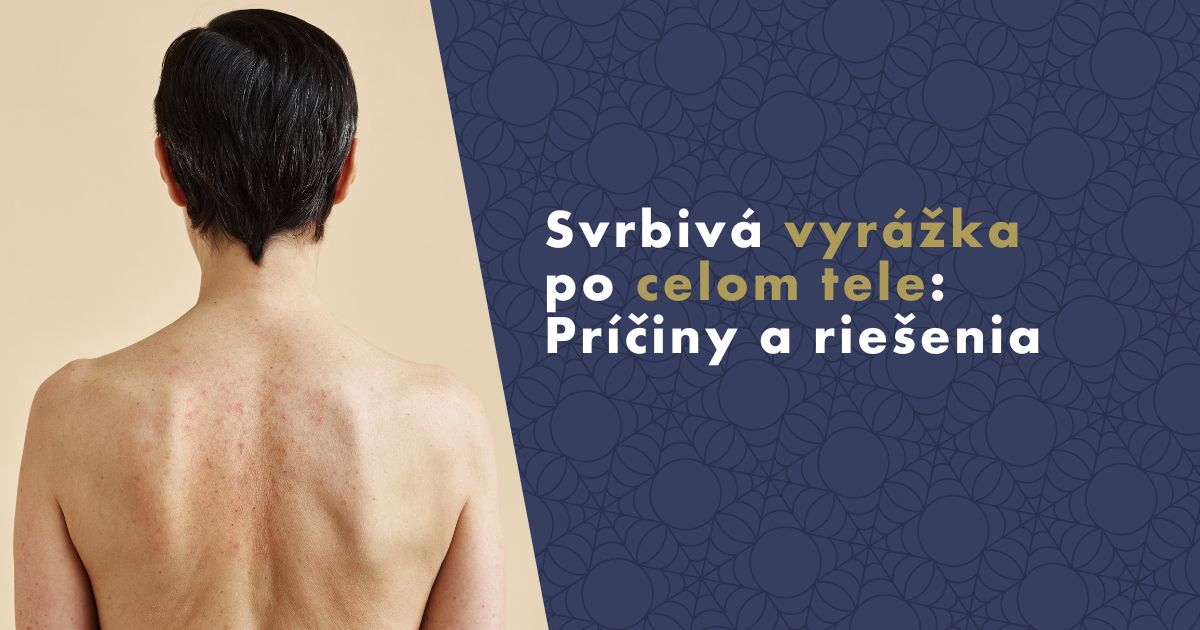 svrbiva-vyrazka-po-celom-tele