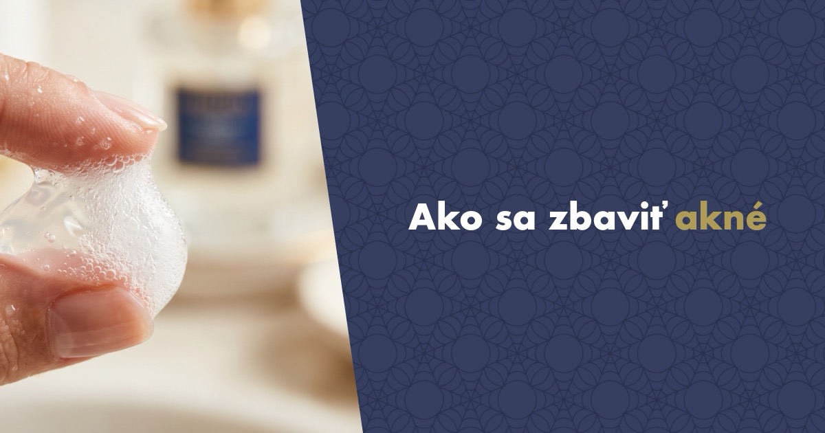 Ako sa zbaviť akné: rady, ktoré mi po rokoch naozaj zabrali