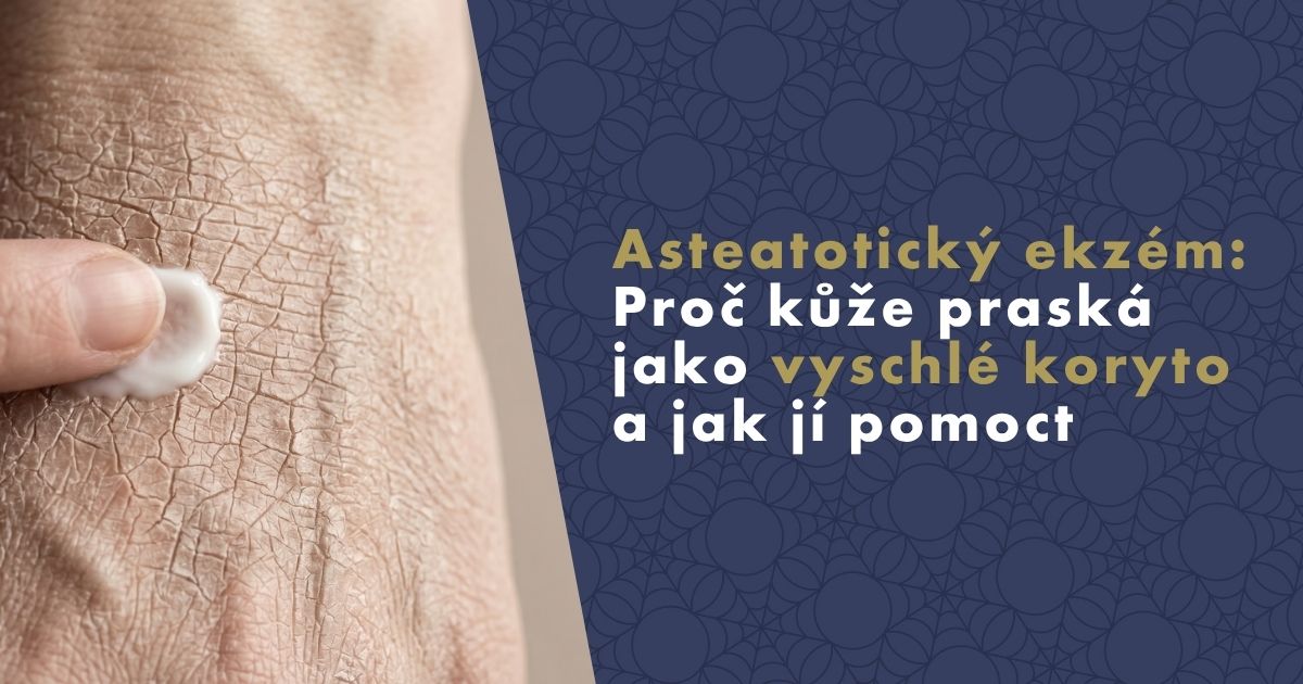 Asteatotický ekzém: Proč kůže praská jako vyschlé koryto a jak jí pomoct