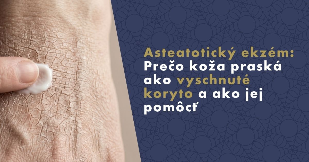 Asteatotický ekzém: Prečo koža praská ako vyschnuté koryto a ako jej pomôcť