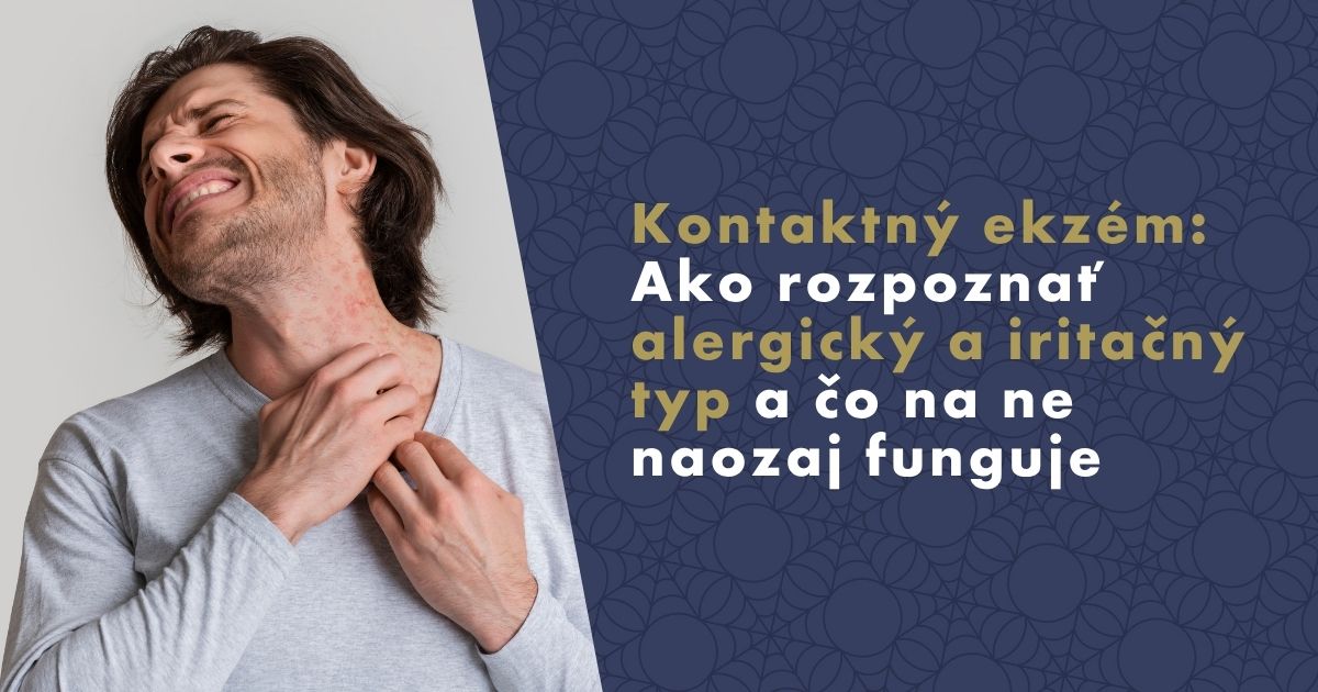 Kontaktný ekzém: Ako rozpoznať alergický a iritačný typ a čo na ne naozaj funguje