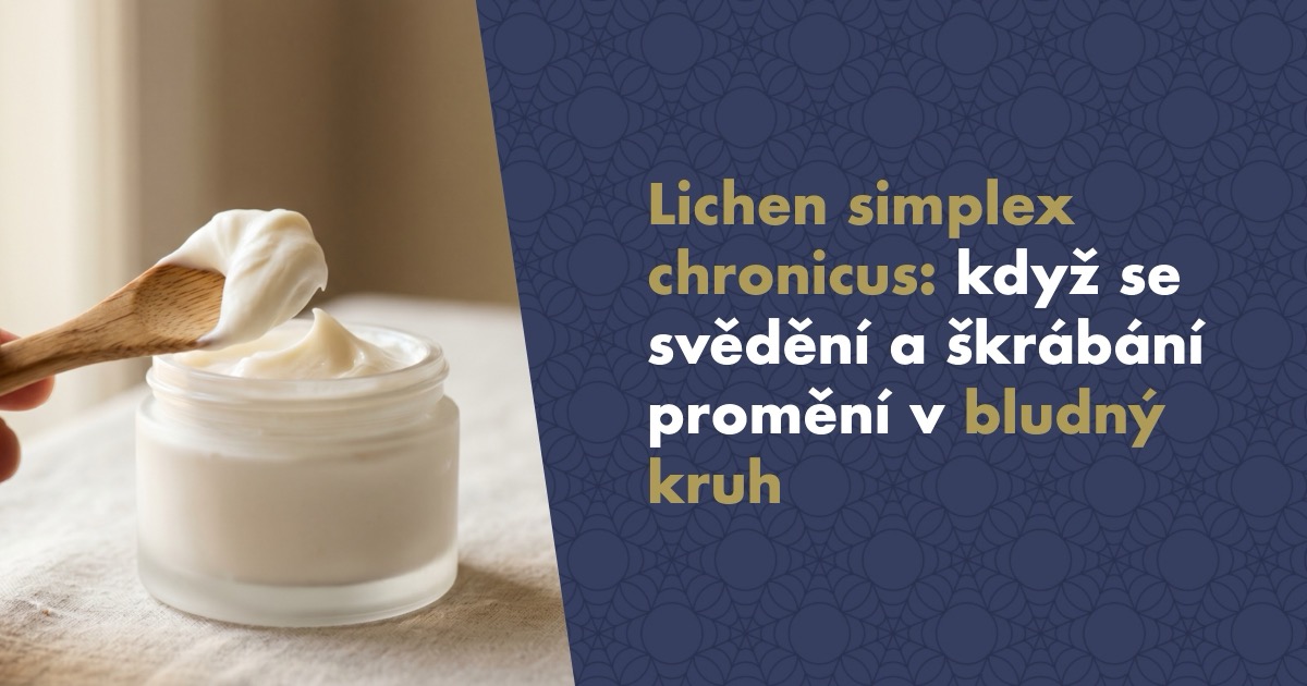 Lichen simplex chronicus (neurodermatitida): Když se svědění a škrábání promění v bludný kruh
